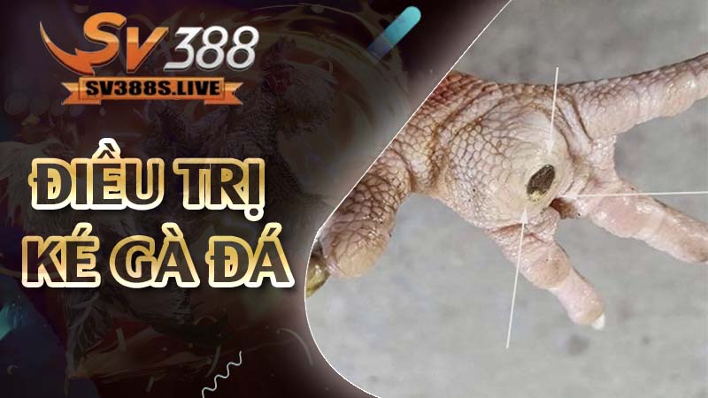 điều trị ké gà đá